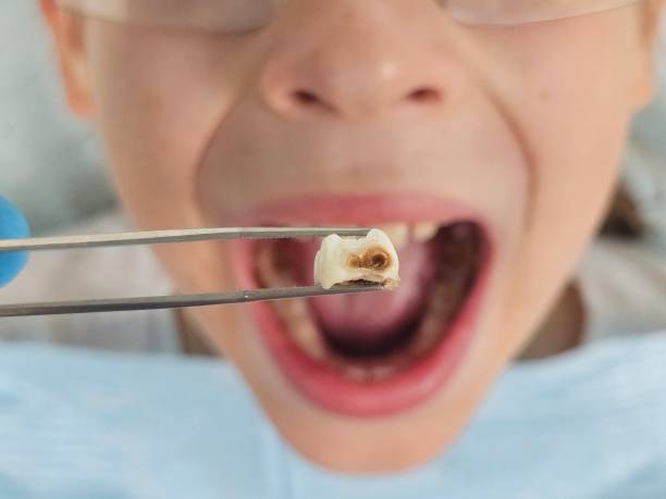Best Emergency Denture Repair in Harvey, IL
